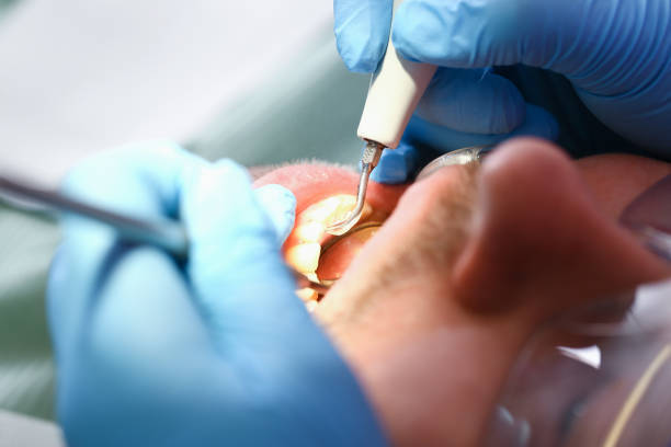 Best Dentist for Tooth Abscess  in Marmet, WV